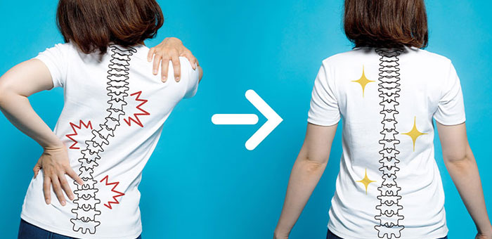 Chiropractic for good posture in Santa Rosa