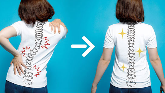 Chiropractic for good posture in Santa Rosa