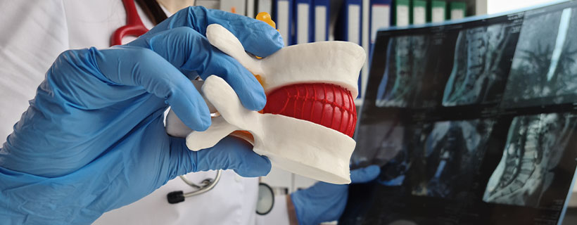 patient suffering from herniated disc in need of chiropractor in Santa Rosa